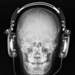 X-RAY